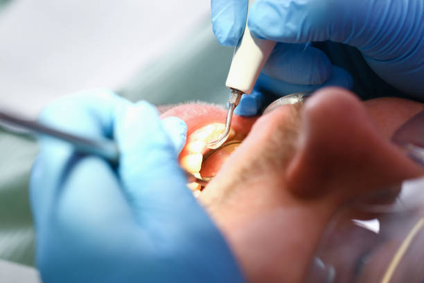 Best Emergency Broken Tooth Repair in Marietta, OK