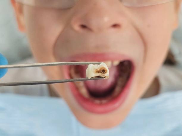 Best Emergency Broken Tooth Repair in Marietta, OK